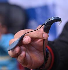 Hearing Loss Treatment Meerut