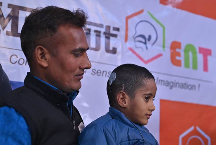 Govt. Funded Cochlear Implant Program ADIP SCHEME 1