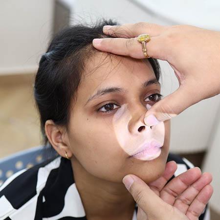 Dust Allergy Treatment Meerut