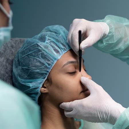 Septoplasty treatment Meerut