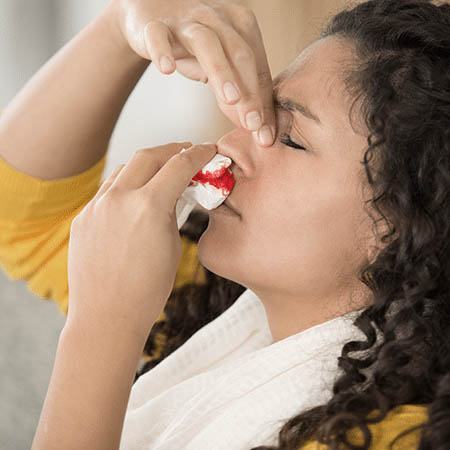 Epistaxis (Nose Bleeding) treatment Meerut