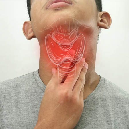 Throat Tumors Treatment Meerut